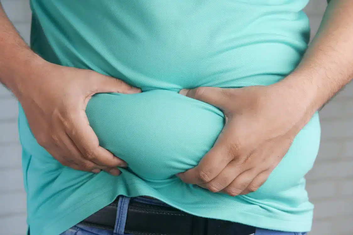 Immagine in evidenza del post: Lipedema: la terapia compressiva può essere d’aiuto?