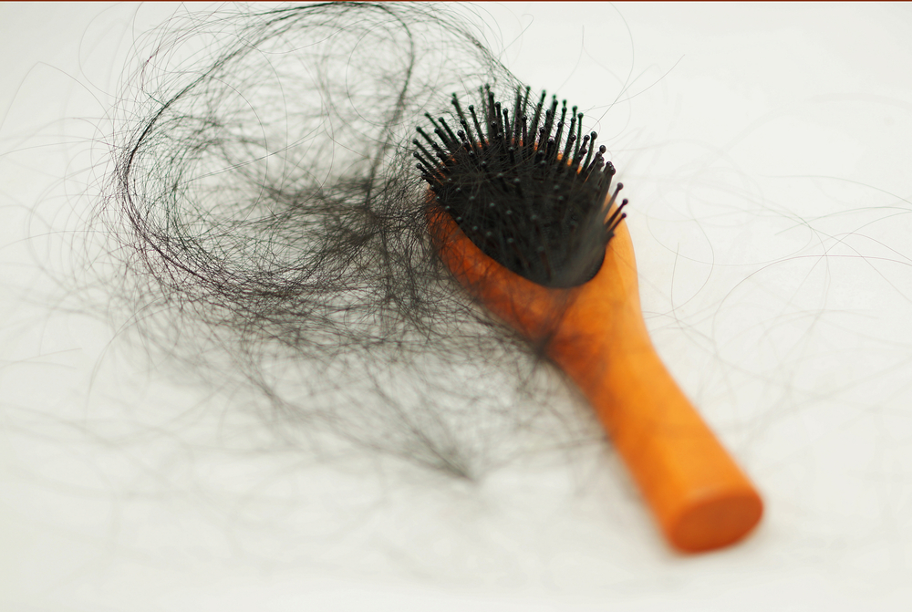 Post precedente: Rimedi alla caduta dei capelli: scopriamo le soluzioni più diffuse